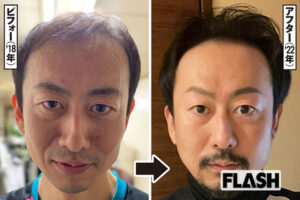 “発毛芸人” デルピエロ山口　薄毛に悩むこと10年間…独自の「1日5分頭…