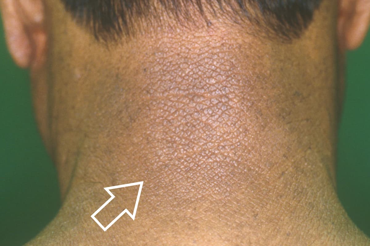 局所塗布で顔の皮膚を明るくできますか?