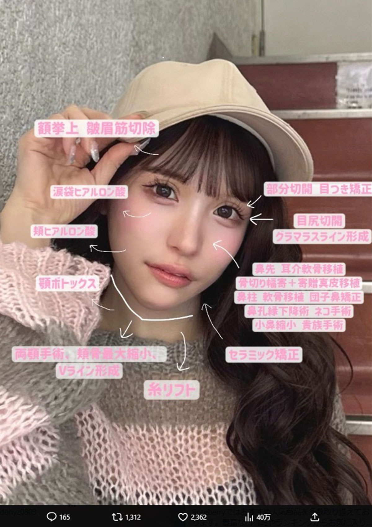 これまでおこなった美容整形を羅列した画像。総額で2600万円かかっているという（写真・本人のXより）