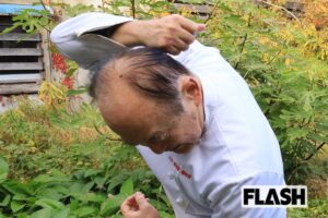 顔を狙ってくるクマと死闘…頭蓋骨が露出、耳たぶ欠損、背中に無数の切り傷「…