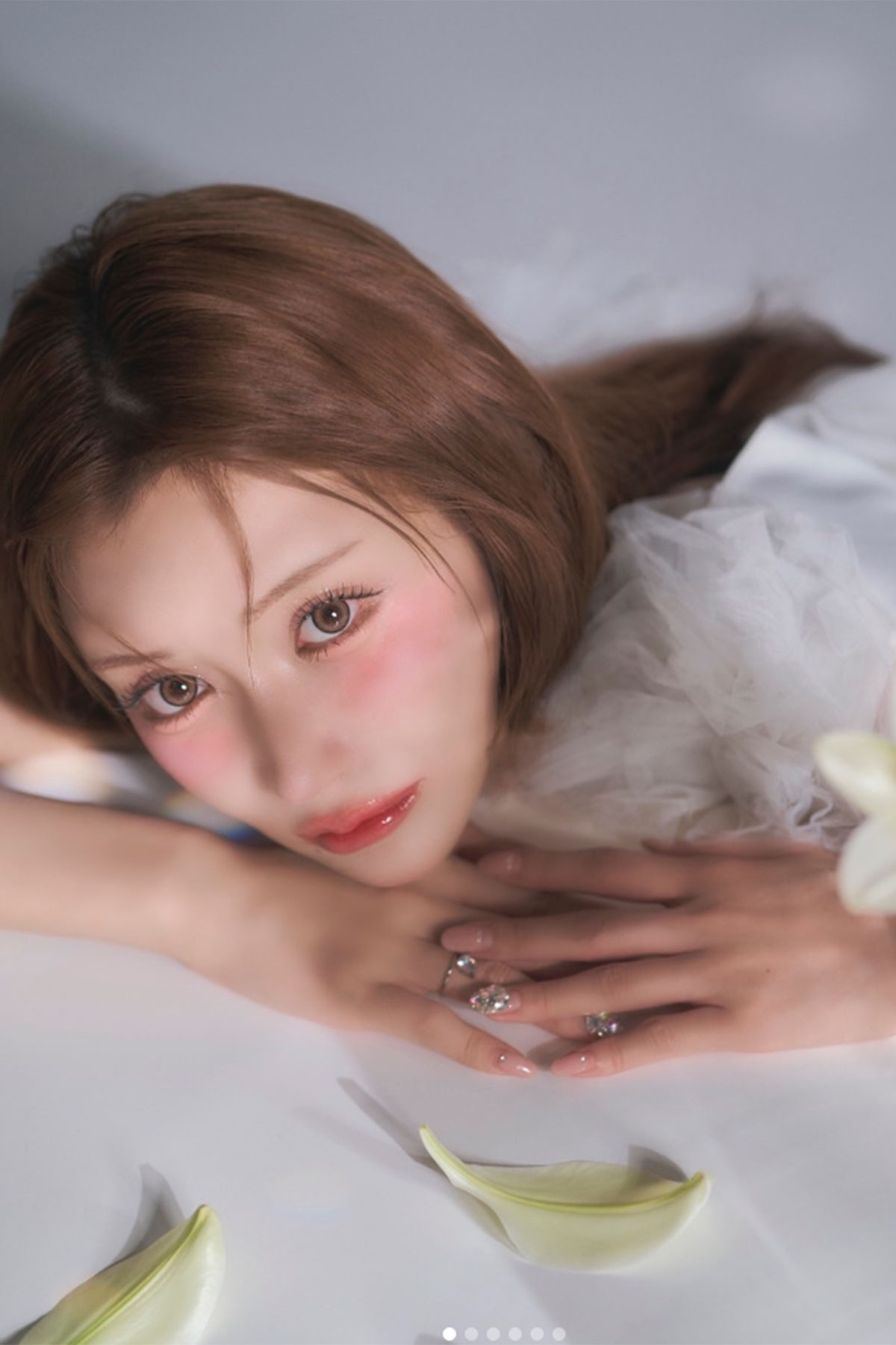 明日花キララ「死んじゃいけない」 美容整形の全身麻酔でパニック、前歯が欠けた姿に「そこまでして」分かれる賛否