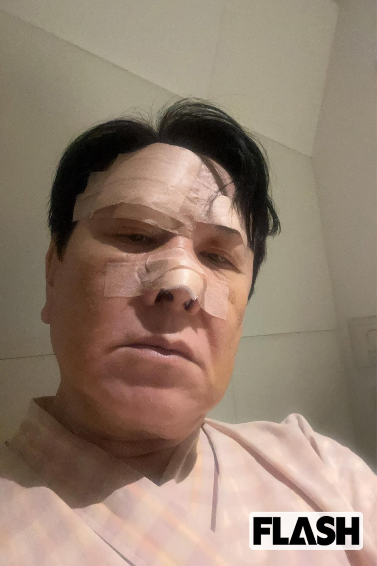 ケガの療養中の三ツ矢雄二