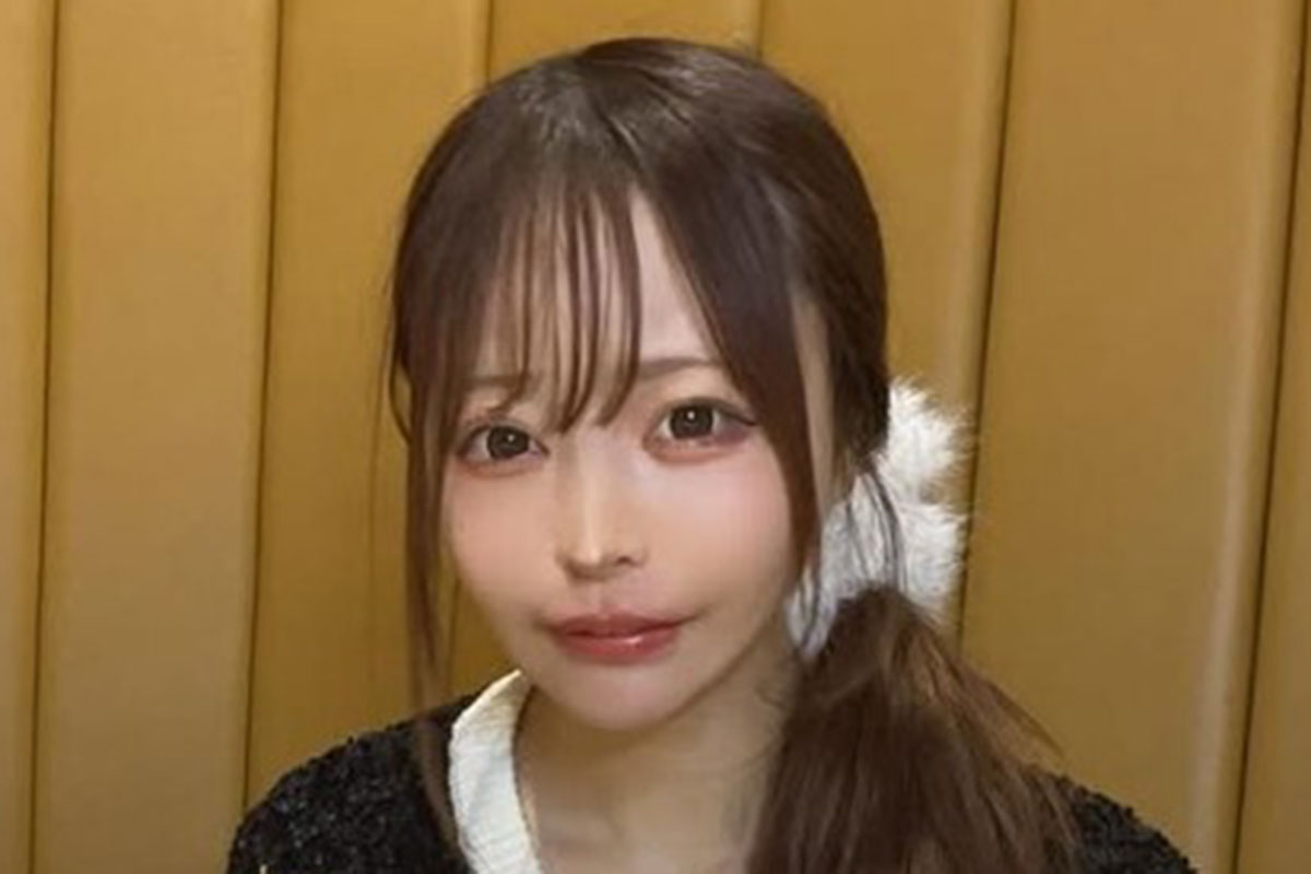 大人気の美人大食いYouTuberが全身の“あざ”写真を投稿し心配の声　…