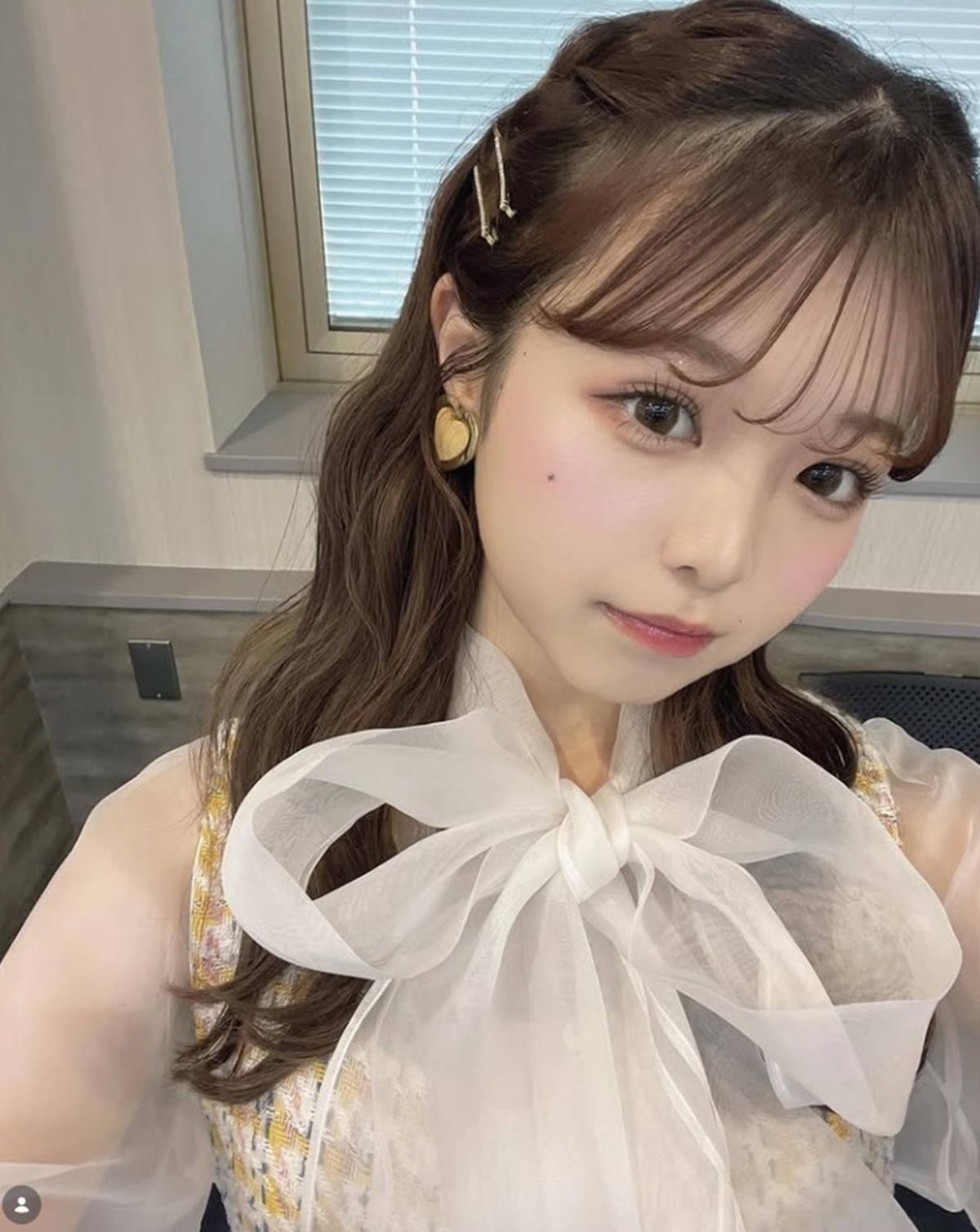 1年ぶり復帰の『今日好き』元メンバー、顔の違和感を指摘する声に壮絶事故を告白「顔の骨が全部折れていた」