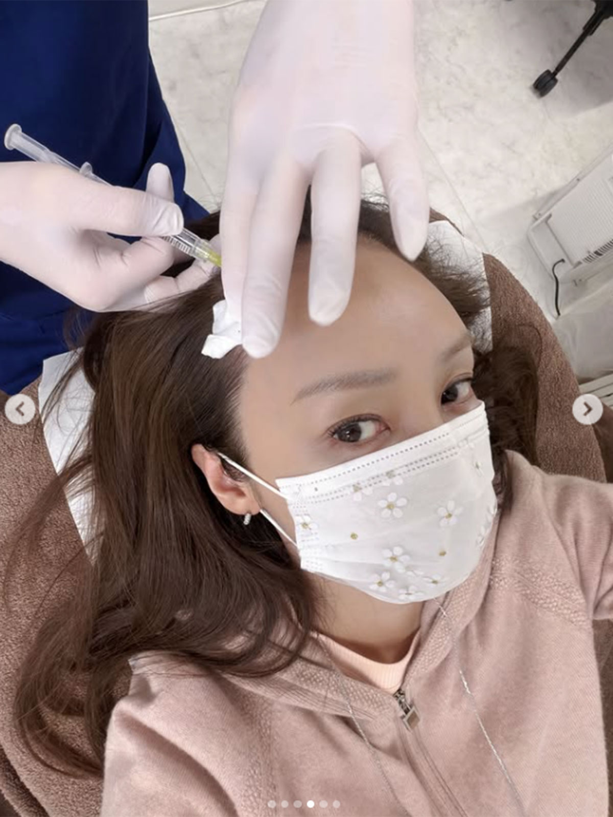 神田うののInstagramより。薄毛治療をおこなったことを報告した