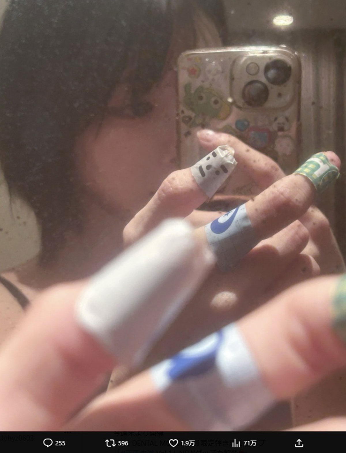 あのちゃんが公開した絆創膏を大量に貼り付けた指の写真。包丁と火傷が原因だという（写真・本人のXより）