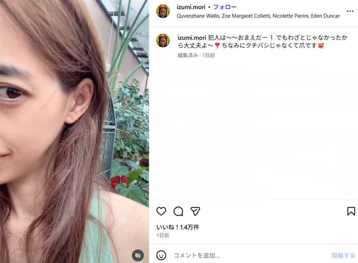 ペットの鳥の爪で傷を負ってしまったようだ。本人は《わざとじゃなかったから大丈夫よ~》と明るいメッセージを添えていた(画像・『Izumi Mori ★ 森 泉』のInstagram「izumi.mori」より)