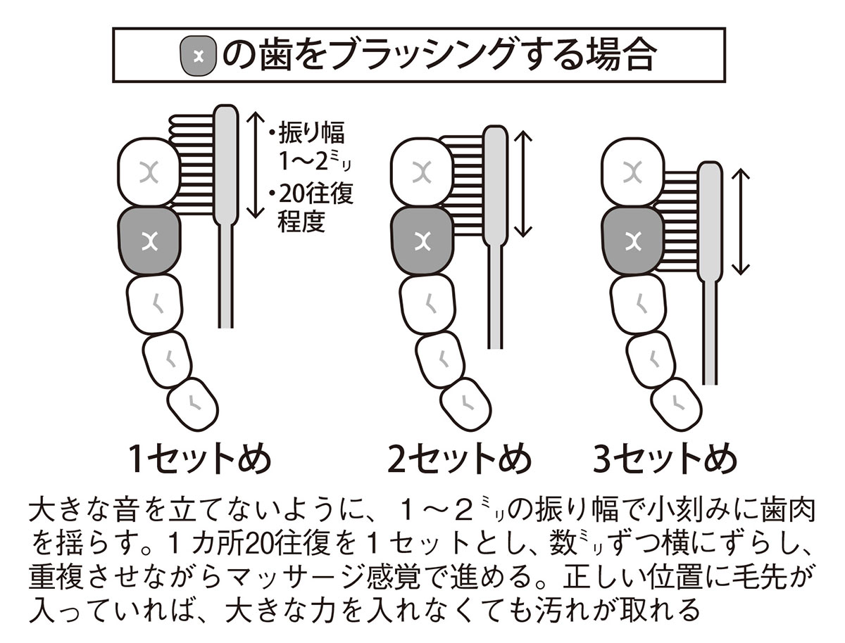 ブラッシング時の振り幅と往復回数