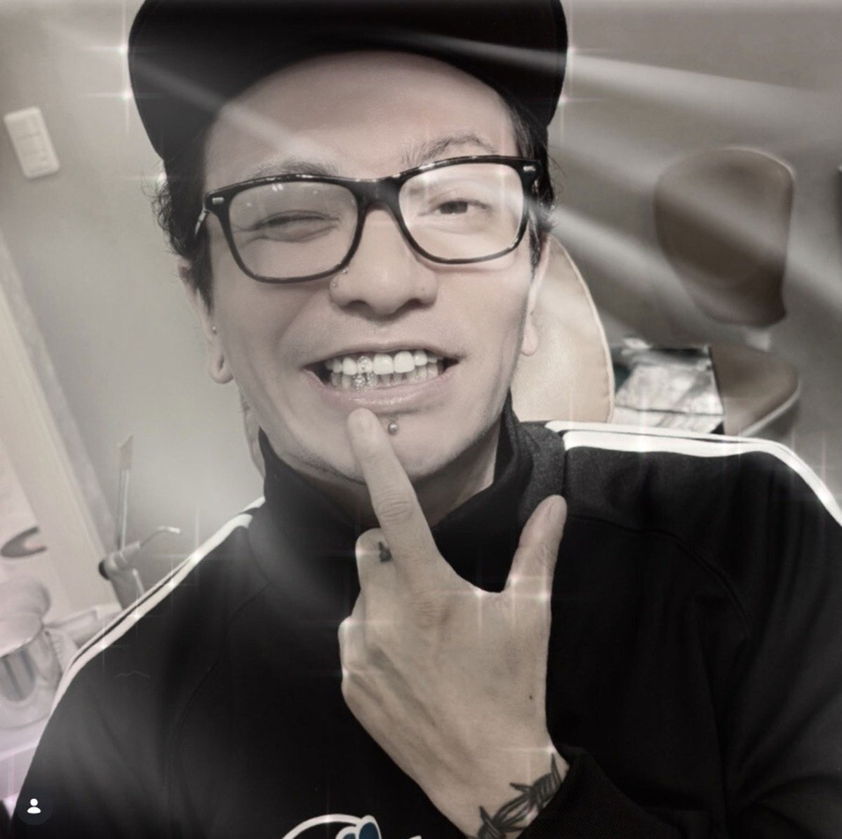 上下の歯3本に“ジュエリー加工”をおこなった田中聖。複数回の逮捕を経て、音楽活動に邁進しているようだ（画像・『ティースジュエリー　A Dental Clinic道玄坂』のInstagram「@teethjewelry_._」より）